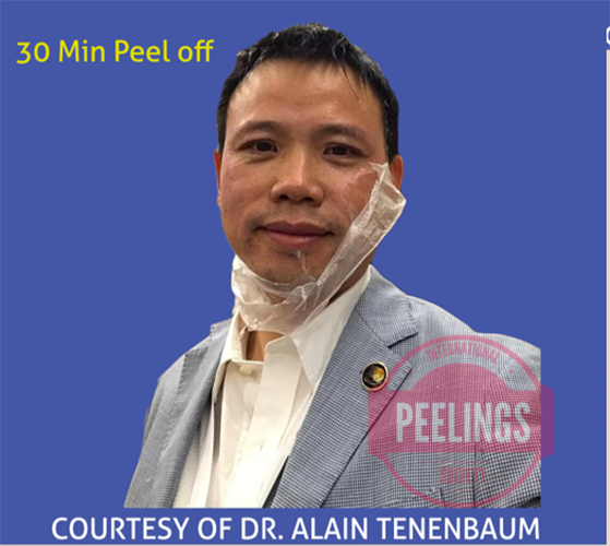 Peel for Asian Skin